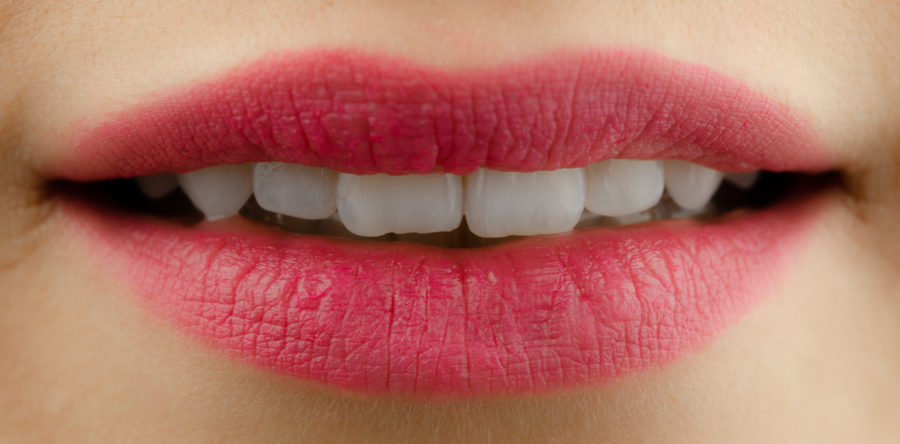 korunky, můstky, fazety